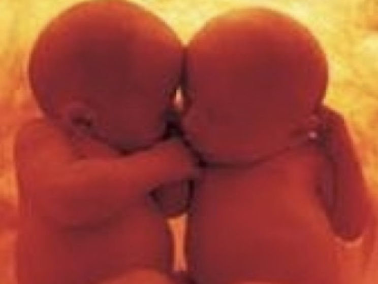 Gemelli embrioni feti vita intrauterina